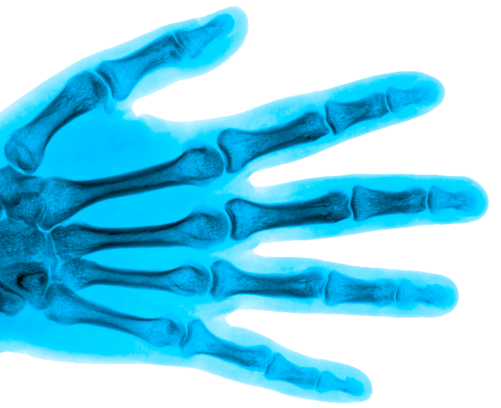 Hand